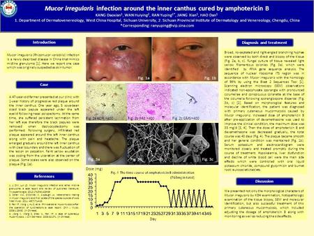 Mucor irregularis infection around the inner canthus cured by amphotericin B KANG Daoxian 1, WAN Huiying 2, RAN Yuping 1*, JIANG Xian 1, HAO Dan 1 1. Department.