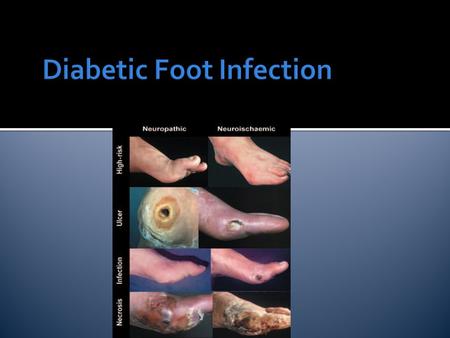 Diabetic Foot Infection