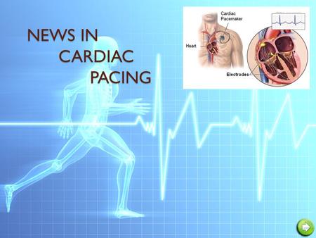 NEWS IN CARDIAC PACING NEWS IN CARDIAC PACINGHeart Cardiac Pacemaker.