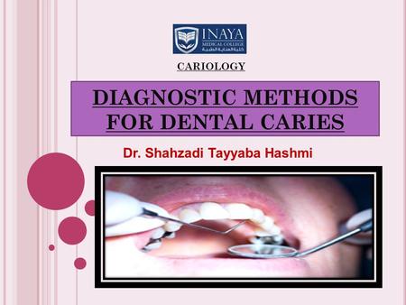 DIAGNOSTIC METHODS FOR DENTAL CARIES