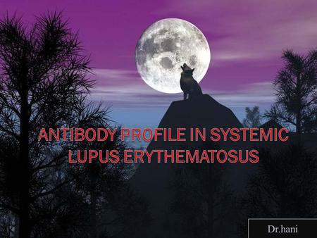 Antibody profile in Systemic Lupus Erythematosus