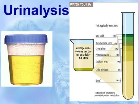 Urinalysis.