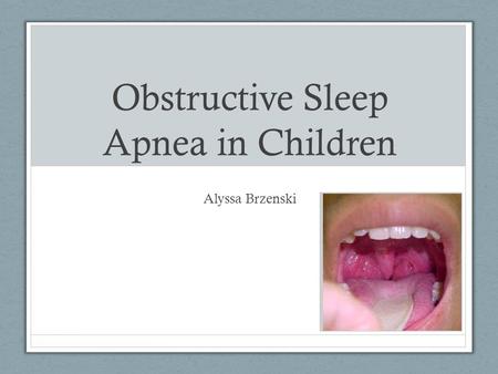 Obstructive Sleep Apnea in Children