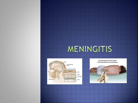 Meningitis.