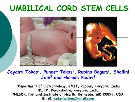 UMBILICAL CORD STEM CELLS