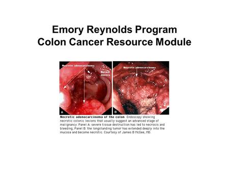 Emory Reynolds Program Colon Cancer Resource Module