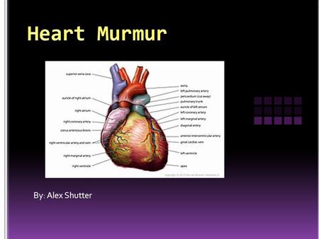 By: Alex Shutter. … A heart murmur is an extra or unusual sound heard during heartbeat. Heart murmurs can vary in sounds. Some can be very loud and some.