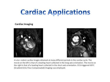 Cardiac Imaging In vivo rodent cardiac images obtained at many different periods in the cardiac cycle. The movie on the left is that of a beating heart.