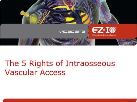 The 5 Rights of Intraosseous Vascular Access