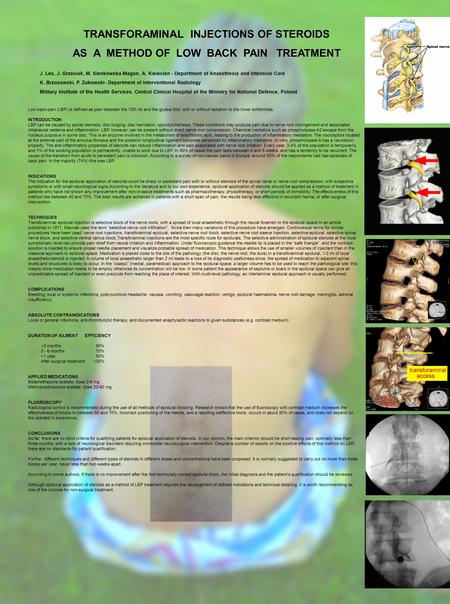 TRANSFORAMINAL INJECTIONS OF STEROIDS AS A METHOD OF LOW BACK PAIN TREATMENT J. Les, J. Grzesiak, M. Sienkowska-Magon, A. Kwiecien - Department of Anaesthesia.