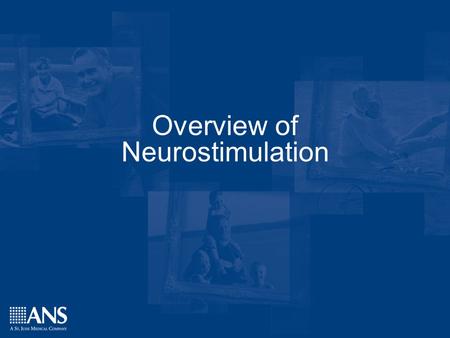 Overview of Neurostimulation