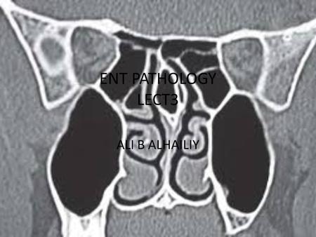 ENT PATHOLOGY LECT3 ALI B ALHAILIY. ENT (ear, nose, and throat) is the branch of medicine and surgery that specializes in the diagnosis and treatment.