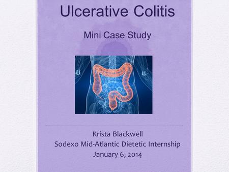 Ulcerative Colitis Mini Case Study Krista Blackwell Sodexo Mid-Atlantic Dietetic Internship January 6, 2014.