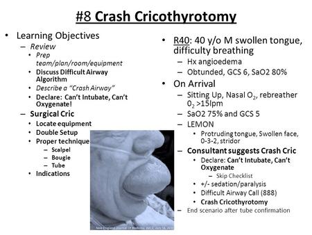 #8 Crash Cricothyrotomy Learning Objectives – Review Prep team/plan/room/equipment Discuss Difficult Airway Algorithm Describe a “Crash Airway” Declare: