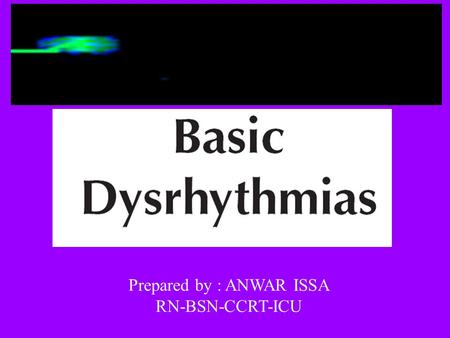 Prepared by : ANWAR ISSA RN-BSN-CCRT-ICU. P wave : is P wave normal ? PR interval : is PR interval normal ? QRS complex : is QRS normal ? P-QRS relation.