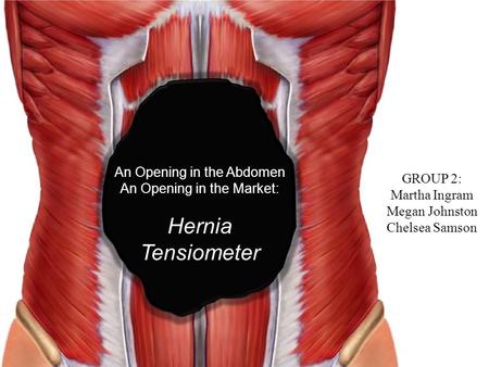 An Opening in the Abdomen An Opening in the Market: Hernia Tensiometer GROUP 2: Martha Ingram Megan Johnston Chelsea Samson.