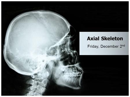 Axial Skeleton Friday, December 2 nd. Skull Bones Review Mental Foramen.