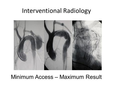 Interventional Radiology Minimum Access – Maximum Result.