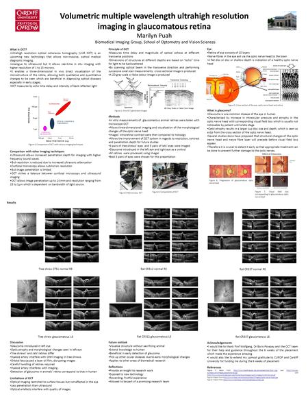 What is OCT? Ultrahigh resolution optical coherence tomography (UHR OCT) is an upcoming new technology that allows non-invasive, optical medical diagnostic.