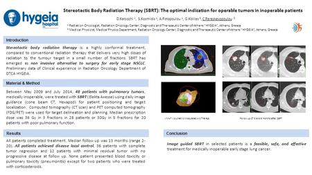 Stereotactic Body Radiation Therapy (SBRT): The optimal indication for operable tumors in inoperable patients D.Katsochi 1, S.Kosmidis 1, A.Fotopoulou.