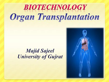 Majid Sajeel University of Gujrat. Objectives Provide a history of transplantation Review organs that are transplantable Define types of transplants Issues.