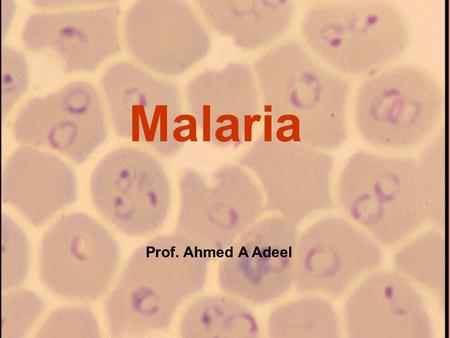 Malaria Prof. Ahmed A Adeel Malaria Species Four species of malaria : – Plasmodium falciparum: malignant tertian malaria – Plasmodium vivax: benign.