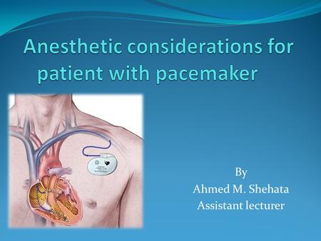 By Ahmed M. Shehata Assistant lecturer. INTRODUCTION 30,000,000 patients worldwide have been implanted pacemakers while 3,000,000- 5,000,000 have a Implantable.