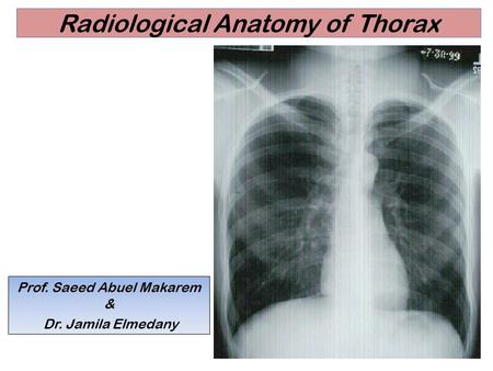 Radiological Anatomy of Thorax