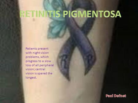 Patients present with night vision problems, which progress to a slow loss of all peripheral vision; central vision is spared the longest.