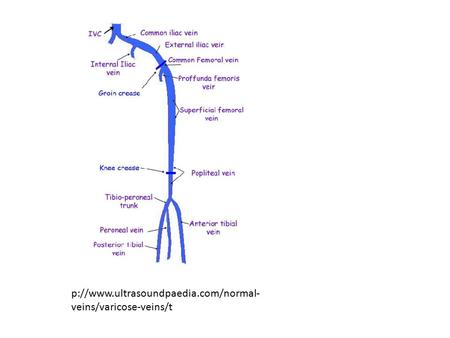 P://www.ultrasoundpaedia.com/normal-veins/varicose-veins/t.