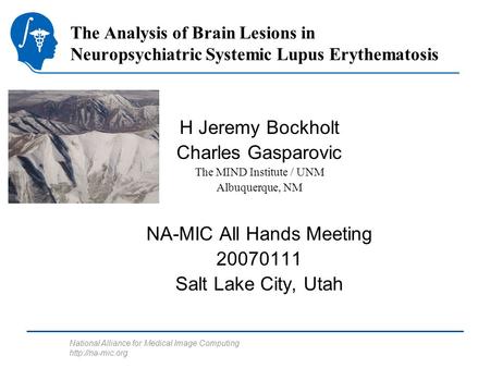 National Alliance for Medical Image Computing  The Analysis of Brain Lesions in Neuropsychiatric Systemic Lupus Erythematosis H Jeremy.