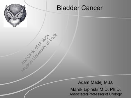 Bladder Cancer Adam Madej M.D. Marek Lipiński M.D. Ph.D. Associated Professor of Urology 2nd Clinic of Urology Medical University of Lodz.