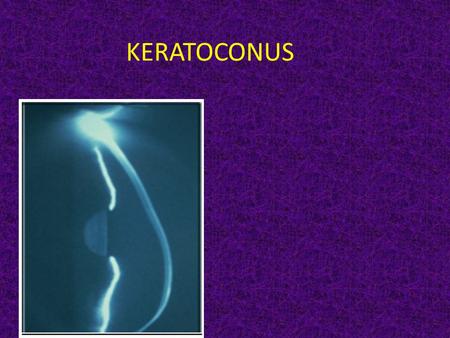 KERATOCONUS. ROOT AND MEANING KERATO HORN, CORNEA KONOS CONE.