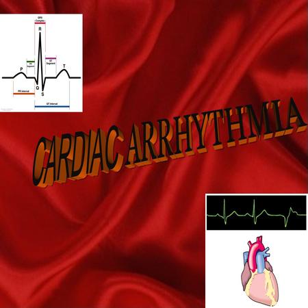 CARDIAC ARRHYTHMIA.