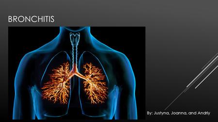 BRONCHITIS By: Justyna, Joanna, and Andriy. WHAT IS BRONCHITIS? Bronchitis is a respiratory disease that causes the mucous membrane lining the bronchial.