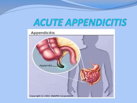 ACUTE APPENDICITIS.