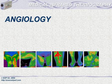 © EDP Srl, 2004  ANGIOLOGY. © EDP Srl, 2004  Angiology Infrared thermography is a very good method in angiology.