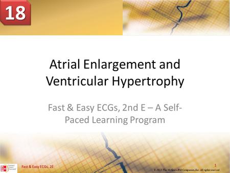 Atrial Enlargement and Ventricular Hypertrophy