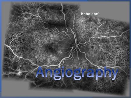 Hhholdorf Angiography.