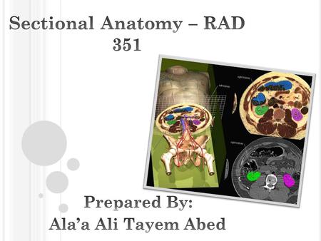 Nuclear Imaging Nuclear medicine is a medical specialty involving the application of radioactive substances in the diagnosis and treatment of disease.