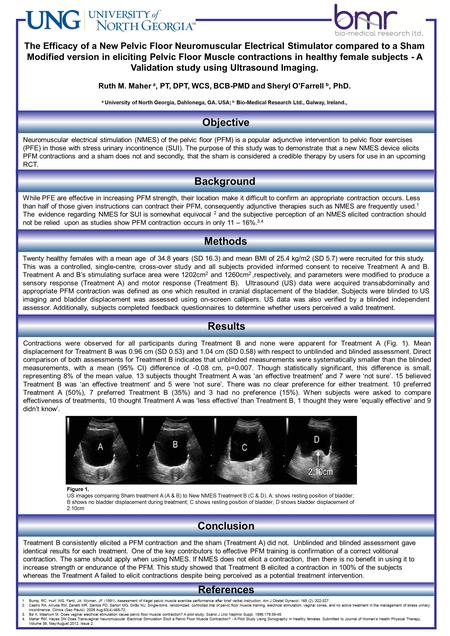 Objective Neuromuscular electrical stimulation (NMES) of the pelvic floor (PFM) is a popular adjunctive intervention to pelvic floor exercises (PFE) in.