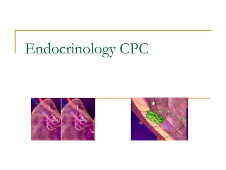 Endocrinology CPC. History/Findings: The patient is a 25 year old concert violinist from Drogheda who presented with a 5 cm x 4 cm x 3 cm mass in the.