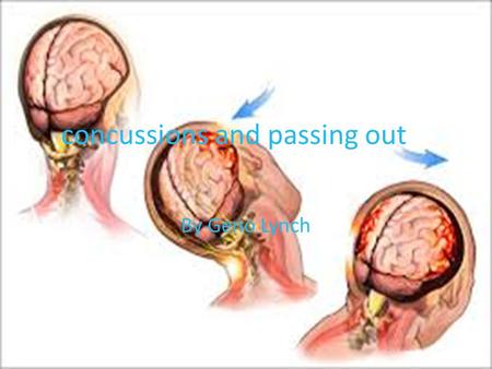 Concussions and passing out By Geno Lynch. The cause of concussions Many people think that concussions are all from a force hitting you in the head but.