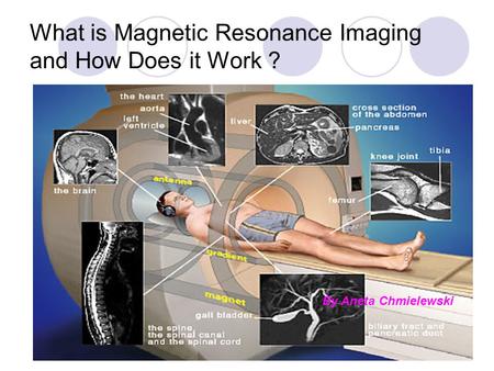 What is Magnetic Resonance Imaging and How Does it Work ?