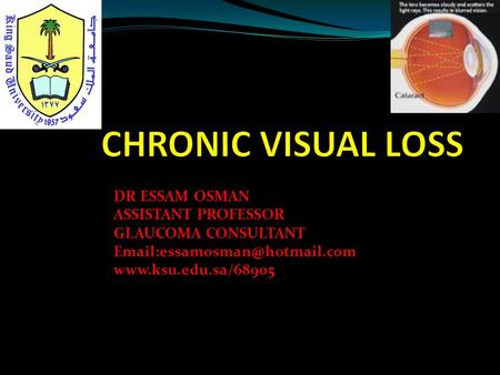 DR ESSAM OSMAN ASSISTANT PROFESSOR GLAUCOMA CONSULTANT