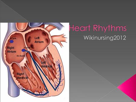  60-100 bpm  Normal sinus rhythm : p-waves followed by a QRS complex, then a T-wave. In a normal HR, sinus node creates an electrical impulse to right.