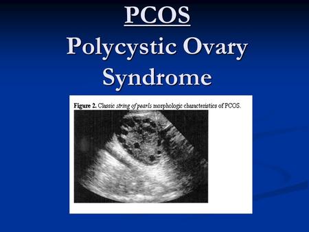 PCOS Polycystic Ovary Syndrome