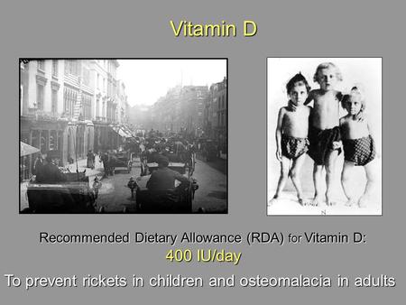 Recommended Dietary Allowance (RDA) for Vitamin D: 400 IU/day To prevent rickets in children and osteomalacia in adults Vitamin D Vitamin D.