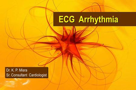 ECG Arrhythmia Dr. K. P. Misra Sr. Consultant Cardiologist.