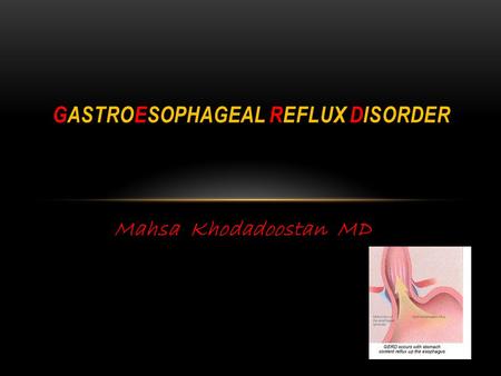 GASTROESOPHAGEAL REFLUX DISORDER